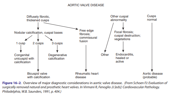 Aortic valve disease.PNG